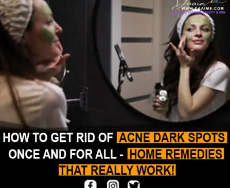 How To Get Rid Of Acne Dark Spots Once And For All - Home Remedies That Really Work!